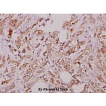 Anti-PKAα/β cat (V191) Antibody from Bioworld Technology (BS1576) - Antibodies.com