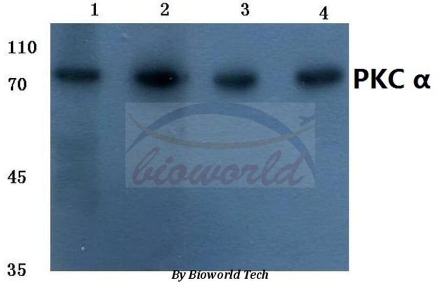 Anti-PKC α (G633) Antibody from Bioworld Technology (BS1577) - Antibodies.com