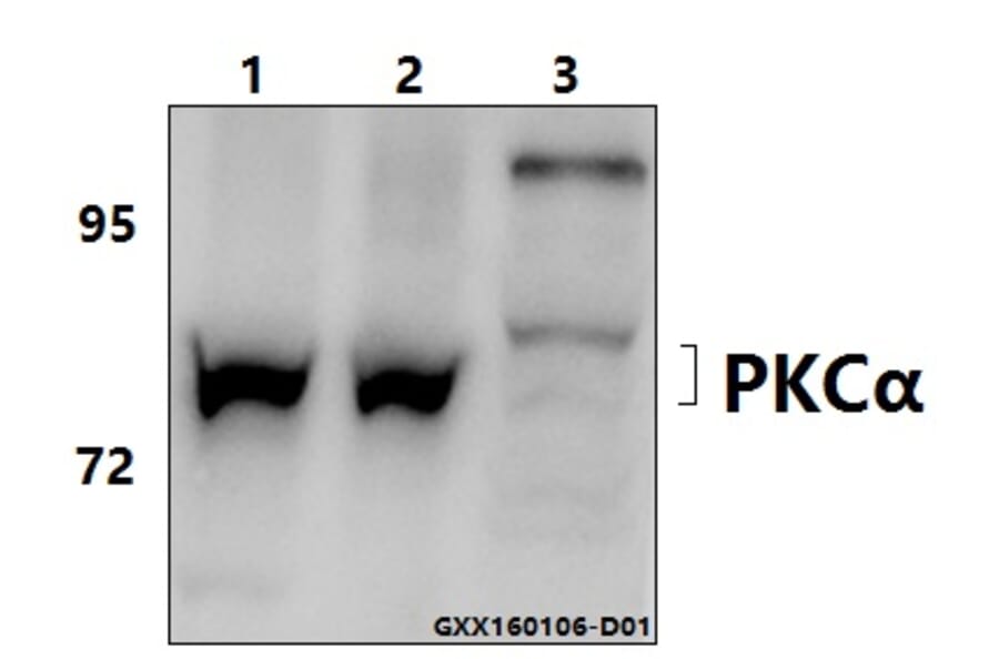 Anti-PKC α (G633) Antibody from Bioworld Technology (BS1577) - Antibodies.com
