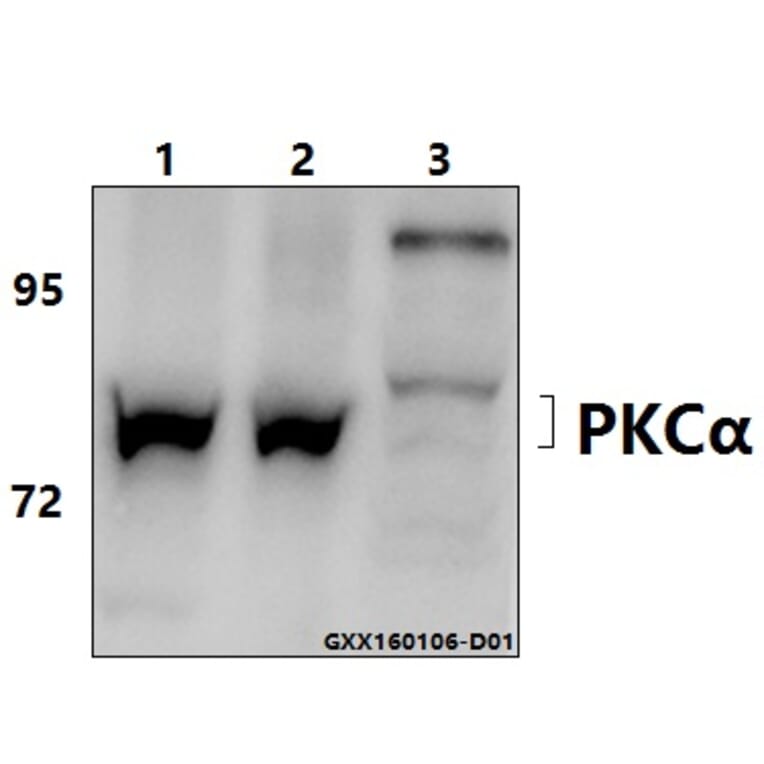 Anti-PKC α (G633) Antibody from Bioworld Technology (BS1577) - Antibodies.com