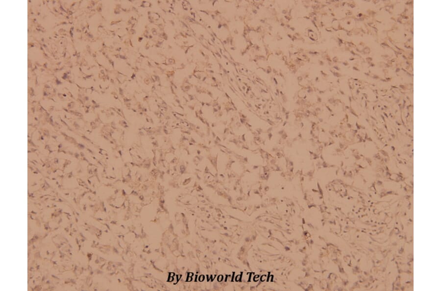 Anti-PKC α (G633) Antibody from Bioworld Technology (BS1577) - Antibodies.com