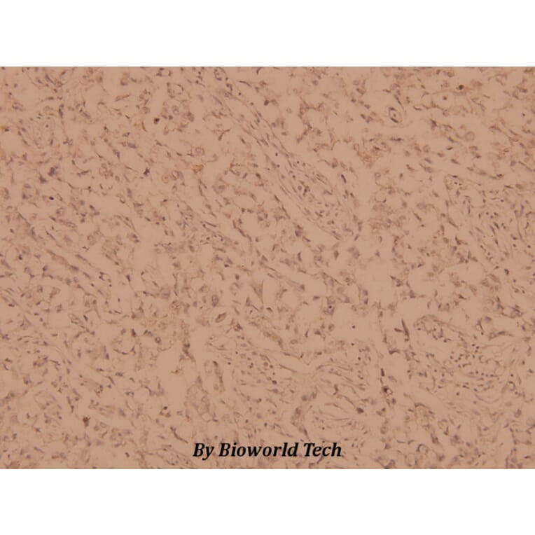 Anti-PKC α (G633) Antibody from Bioworld Technology (BS1577) - Antibodies.com