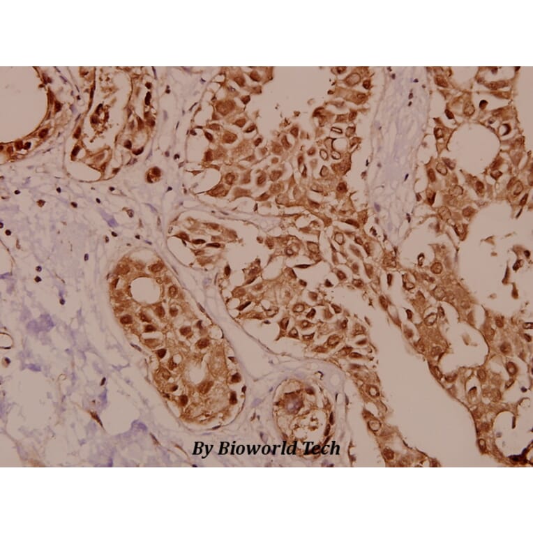 Anti-PKC ζ (P556) Antibody from Bioworld Technology (BS1579) - Antibodies.com