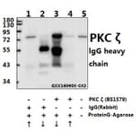 Anti-PKC ζ (P556) Antibody from Bioworld Technology (BS1579) - Antibodies.com