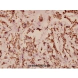 Anti-PKC-pan (T495) Antibody from Bioworld Technology (BS1580) - Antibodies.com