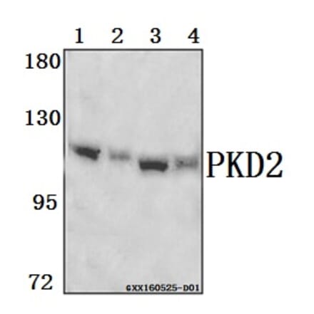 Anti-PKD2 (A872) Antibody from Bioworld Technology (BS1584) - Antibodies.com