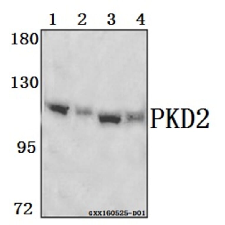 Anti-PKD2 (A872) Antibody from Bioworld Technology (BS1584) - Antibodies.com