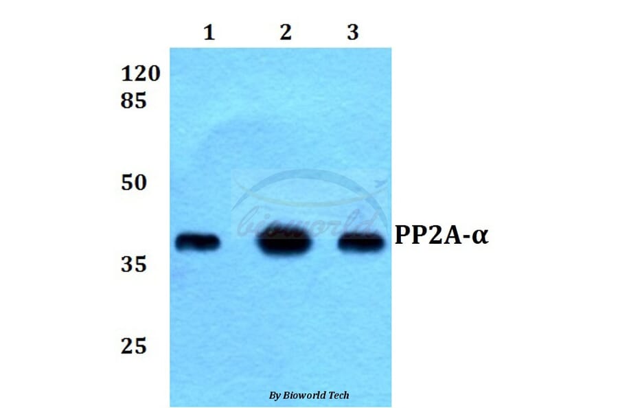 Anti-PP2A-α (T301) Antibody from Bioworld Technology (BS1586) - Antibodies.com