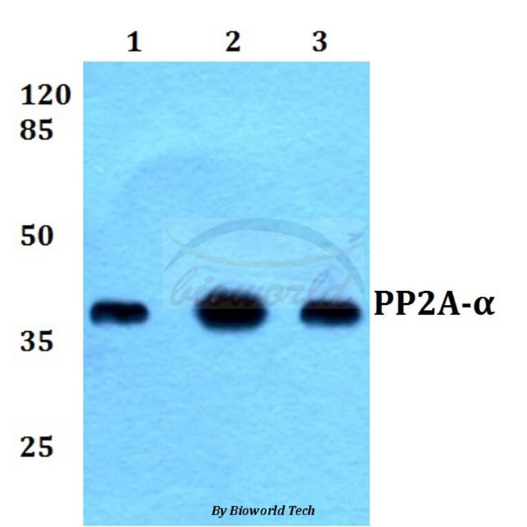 Anti-PP2A-α (T301) Antibody from Bioworld Technology (BS1586) - Antibodies.com