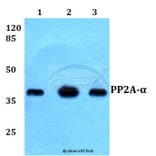 Anti-PP2A-α (T301) Antibody from Bioworld Technology (BS1586) - Antibodies.com