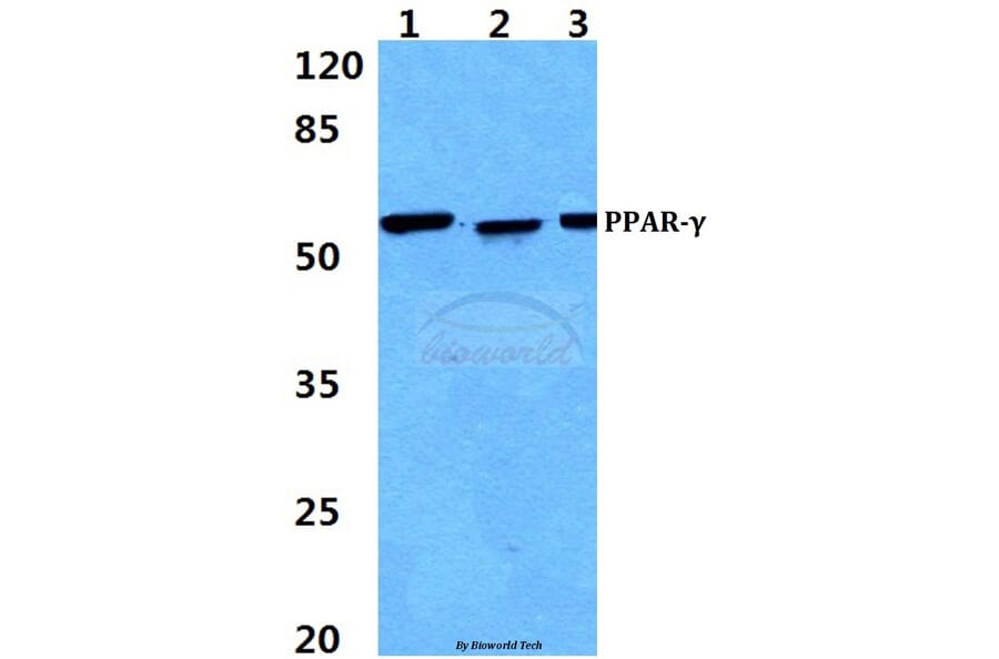Anti-PPAR-γ (I106) Antibody from Bioworld Technology (BS1587) - Antibodies.com