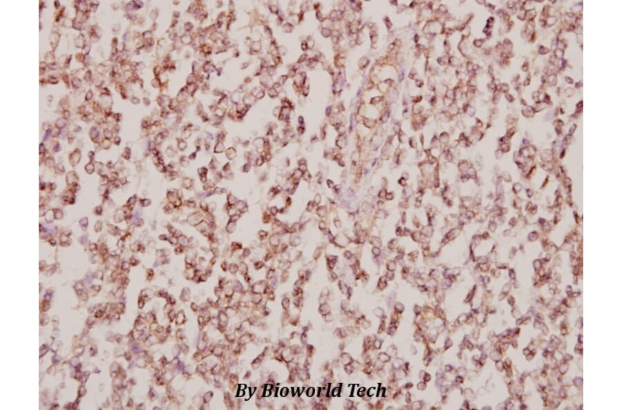 Anti-PPAR-γ (I106) Antibody from Bioworld Technology (BS1587) - Antibodies.com