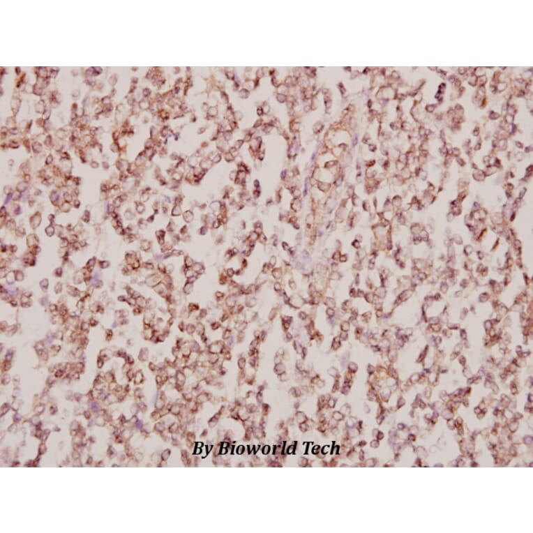 Anti-PPAR-γ (I106) Antibody from Bioworld Technology (BS1587) - Antibodies.com
