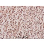 Anti-PPAR-γ (I106) Antibody from Bioworld Technology (BS1587) - Antibodies.com