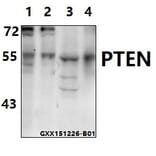Anti-PTEN (Y379) Antibody from Bioworld Technology (BS1588) - Antibodies.com