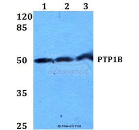 Anti-PTP1B (Y46) Antibody from Bioworld Technology (BS1589) - Antibodies.com