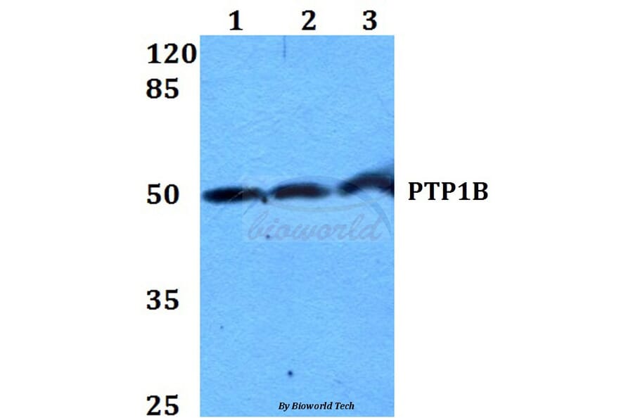Anti-PTP1B (Y46) Antibody from Bioworld Technology (BS1589) - Antibodies.com