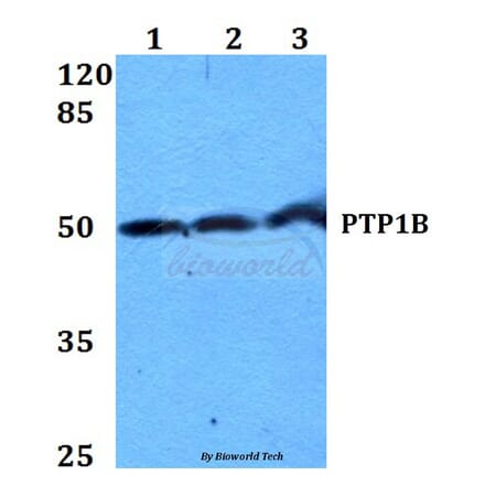 Anti-PTP1B (Y46) Antibody from Bioworld Technology (BS1589) - Antibodies.com