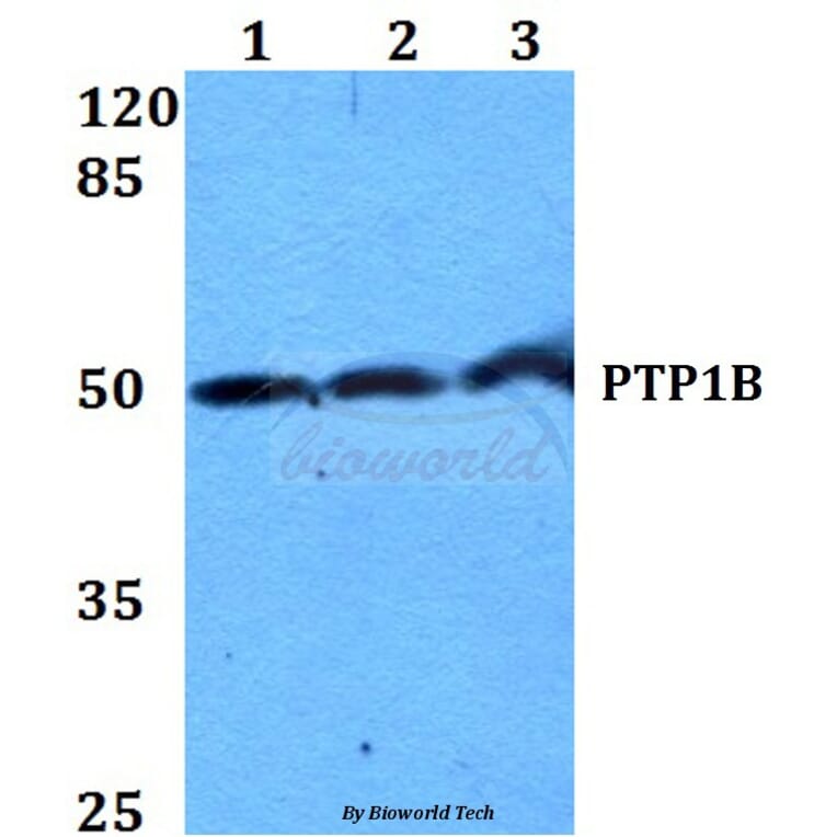Anti-PTP1B (Y46) Antibody from Bioworld Technology (BS1589) - Antibodies.com