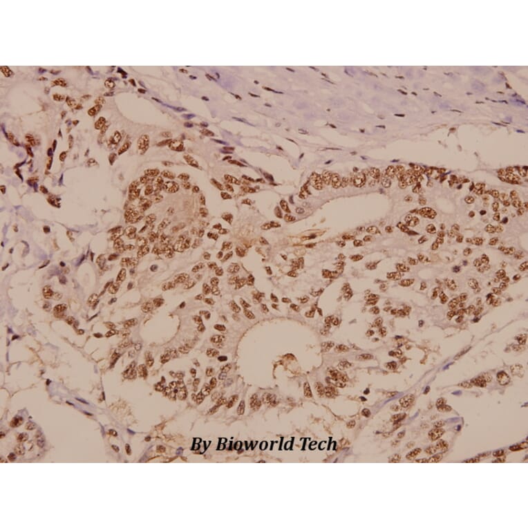 Anti-PTP1B (Y46) Antibody from Bioworld Technology (BS1589) - Antibodies.com