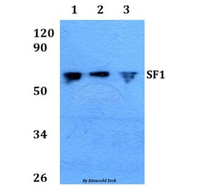 Anti-SF1 (P76) Antibody from Bioworld Technology (BS1593) - Antibodies.com