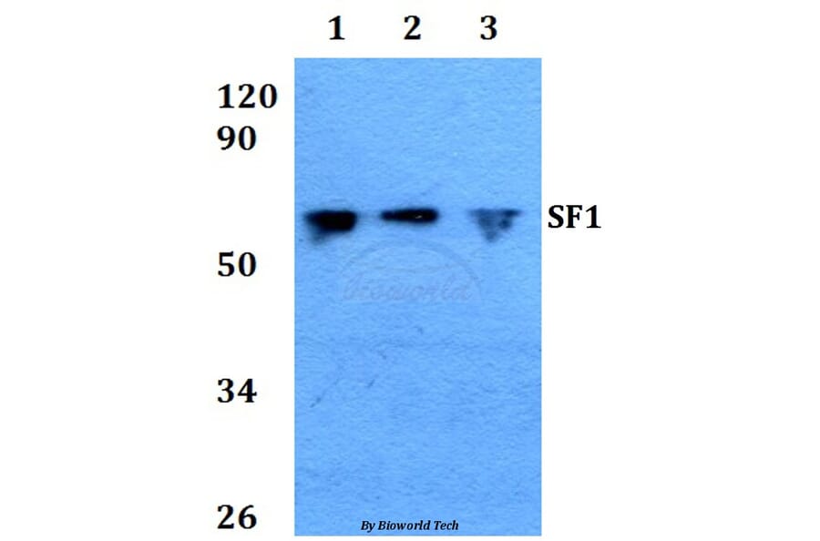 Anti-SF1 (P76) Antibody from Bioworld Technology (BS1593) - Antibodies.com