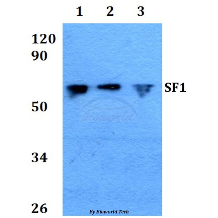 Anti-SF1 (P76) Antibody from Bioworld Technology (BS1593) - Antibodies.com