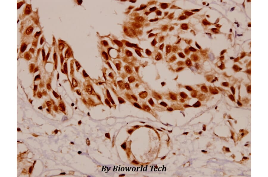 Anti-SF1 (P76) Antibody from Bioworld Technology (BS1593) - Antibodies.com