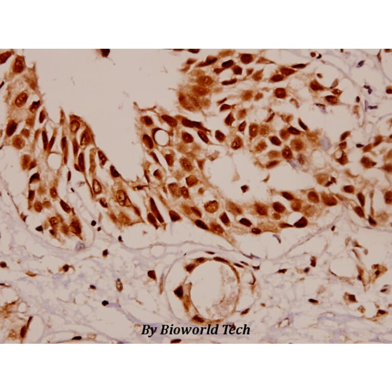 Anti-SF1 (P76) Antibody from Bioworld Technology (BS1593) - Antibodies.com