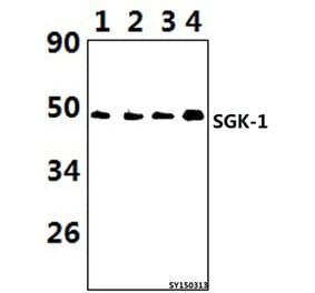 Anti-SGK 1 (P73) Antibody from Bioworld Technology (BS1594) - Antibodies.com