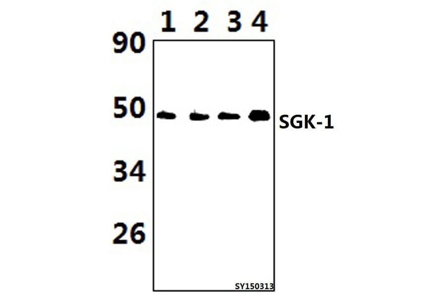 Anti-SGK 1 (P73) Antibody from Bioworld Technology (BS1594) - Antibodies.com