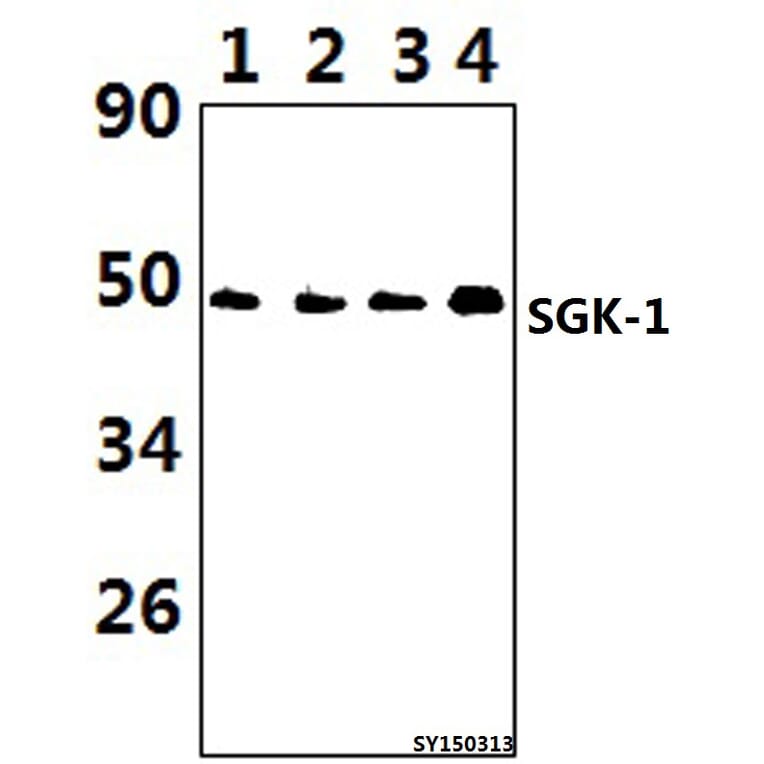 Anti-SGK 1 (P73) Antibody from Bioworld Technology (BS1594) - Antibodies.com