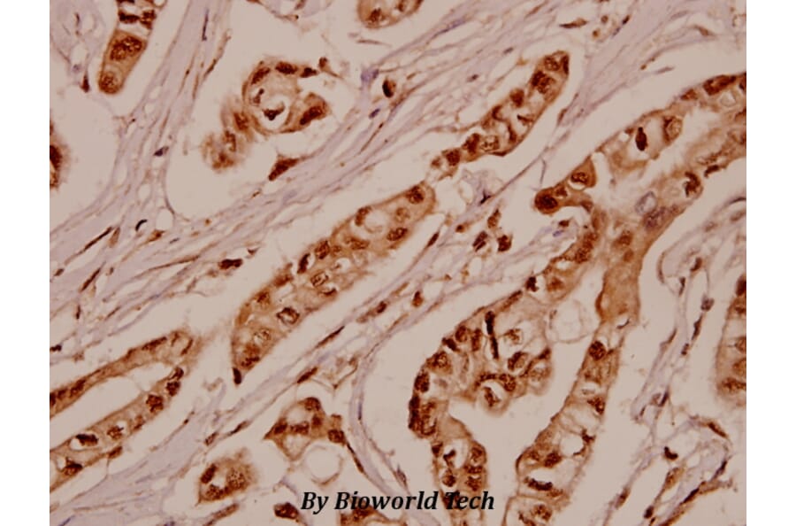 Anti-SGK 1 (P73) Antibody from Bioworld Technology (BS1594) - Antibodies.com