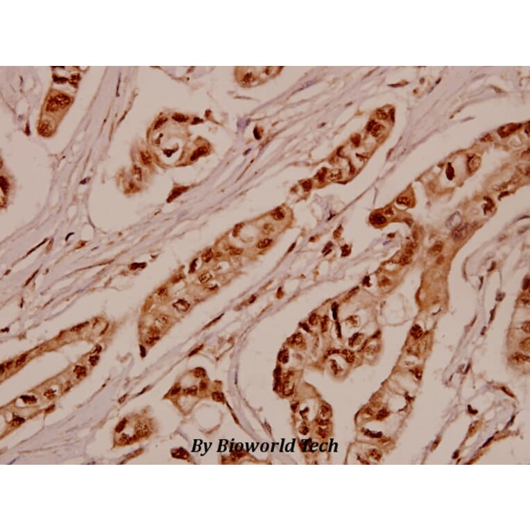 Anti-SGK 1 (P73) Antibody from Bioworld Technology (BS1594) - Antibodies.com