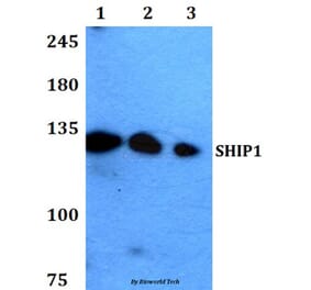 Anti-SHIP1 (M1014) Antibody from Bioworld Technology (BS1595) - Antibodies.com