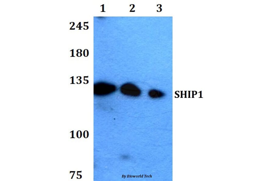 Anti-SHIP1 (M1014) Antibody from Bioworld Technology (BS1595) - Antibodies.com