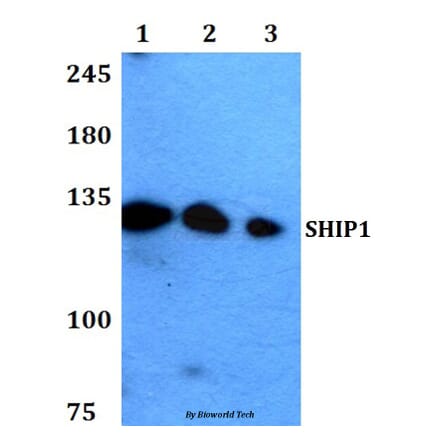 Anti-SHIP1 (M1014) Antibody from Bioworld Technology (BS1595) - Antibodies.com