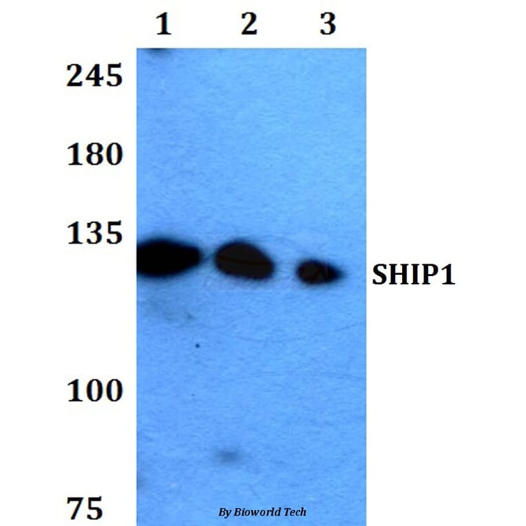 Anti-SHIP1 (M1014) Antibody from Bioworld Technology (BS1595) - Antibodies.com