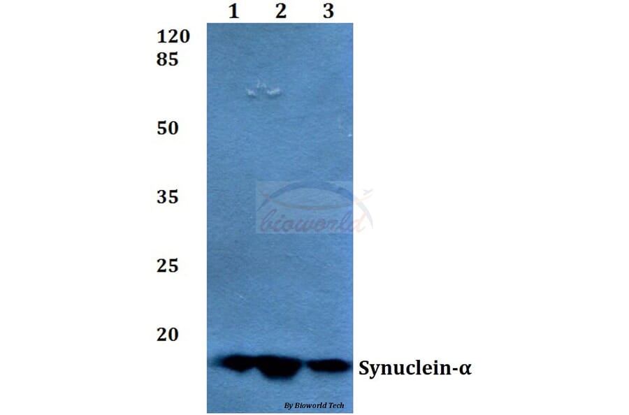 Anti-Synuclein-α (E123) Antibody from Bioworld Technology (BS1596) - Antibodies.com