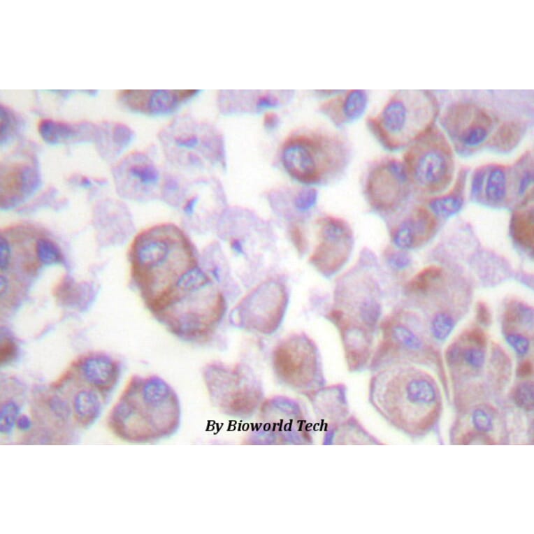 Anti-Synuclein-α (E123) Antibody from Bioworld Technology (BS1596) - Antibodies.com