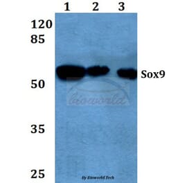 Anti-Sox9 (Q175) Antibody from Bioworld Technology (BS1597) - Antibodies.com