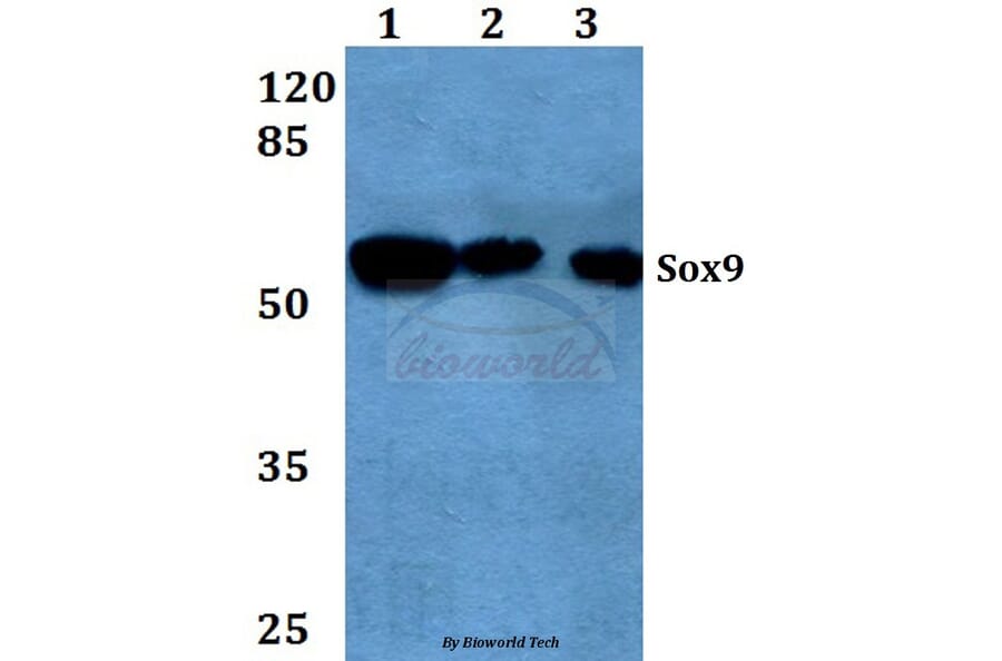 Anti-Sox9 (Q175) Antibody from Bioworld Technology (BS1597) - Antibodies.com