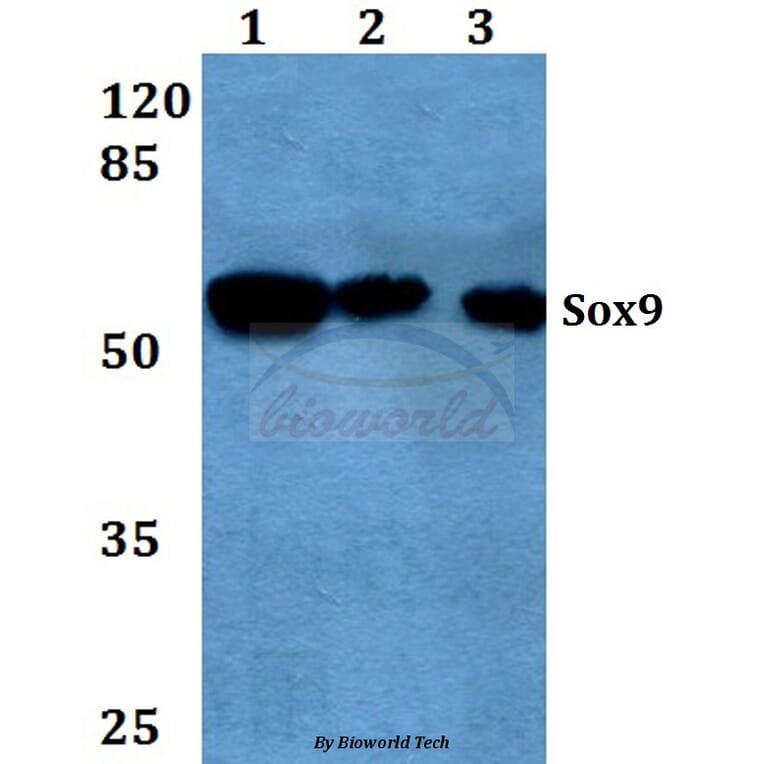 Anti-Sox9 (Q175) Antibody from Bioworld Technology (BS1597) - Antibodies.com