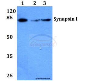 Anti-Synapsin I (T56) Antibody from Bioworld Technology (BS1599) - Antibodies.com