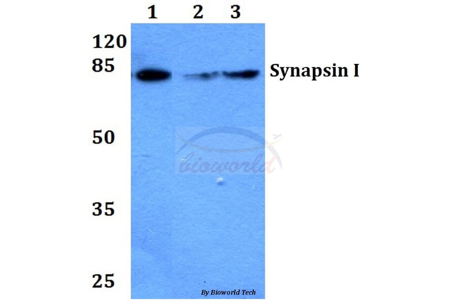 Anti-Synapsin I (T56) Antibody from Bioworld Technology (BS1599) - Antibodies.com