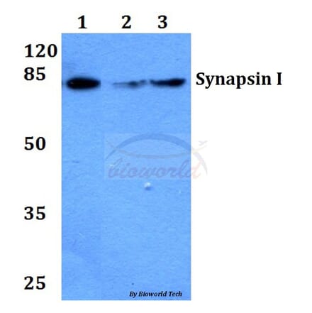 Anti-Synapsin I (T56) Antibody from Bioworld Technology (BS1599) - Antibodies.com