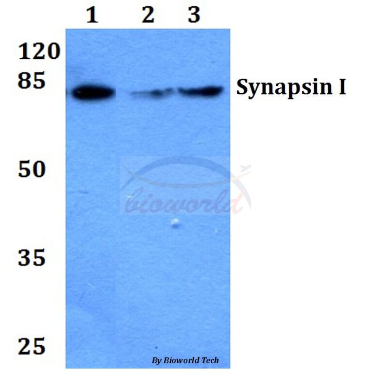 Anti-Synapsin I (T56) Antibody from Bioworld Technology (BS1599) - Antibodies.com