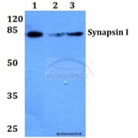 Anti-Synapsin I (T56) Antibody from Bioworld Technology (BS1599) - Antibodies.com
