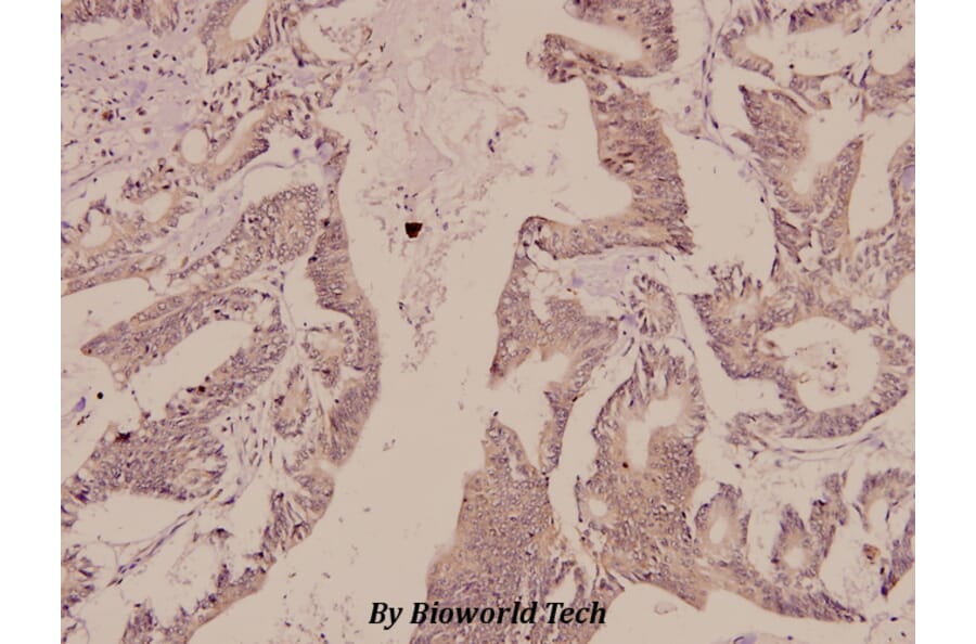 Anti-Synapsin I (T56) Antibody from Bioworld Technology (BS1599) - Antibodies.com