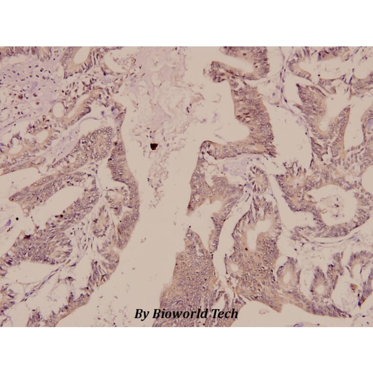 Anti-Synapsin I (T56) Antibody from Bioworld Technology (BS1599) - Antibodies.com